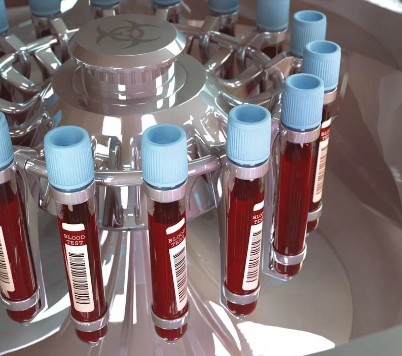  Un examen de sangre ya puede detectar el cáncer 10 años antes de que se manifieste: salvará vidas 