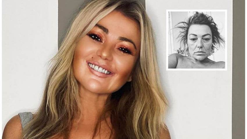 Hermana de Amaia Montero, exvocalista de La Oreja de Van Gogh, habla sobre su estado de salud