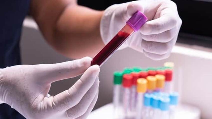 Reducción de las pruebas del VIH durante la pandemia aumentan las preocupaciones sobre la transmisión