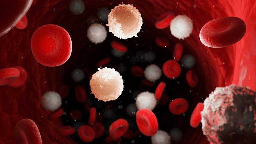 Pruebas genéticas: el futuro terapéutico de la leucemia linfoblástica aguda