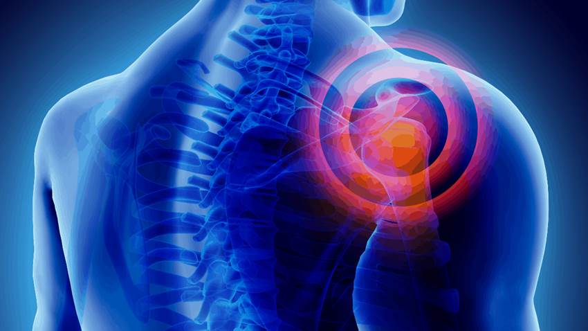 Evalúan nuevas opciones terapéuticas para evitar la sarcopenia en pacientes reumáticos