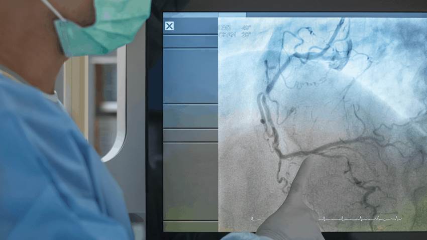 Traslado inmediato a sala de angiografía tiene mejor resultado en paciente con enfermedad cerebrovascular