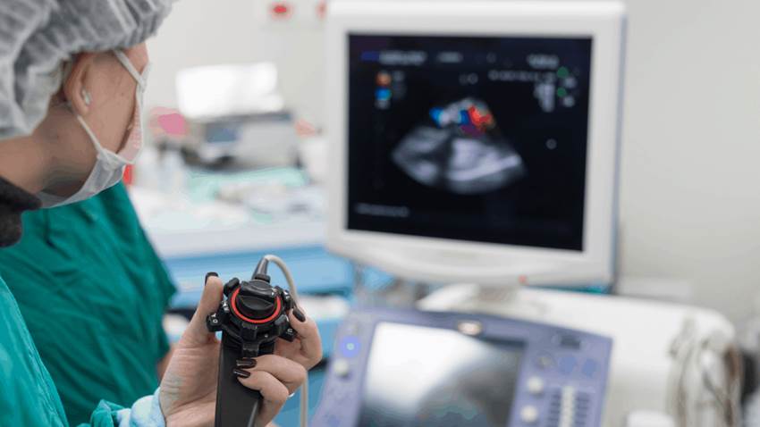 La ecocardiografía predice mejor el riesgo cardiovascular en pacientes con diabetes