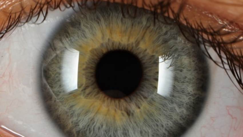 El adelgazamiento de la retina, indicador precoz de párkinson