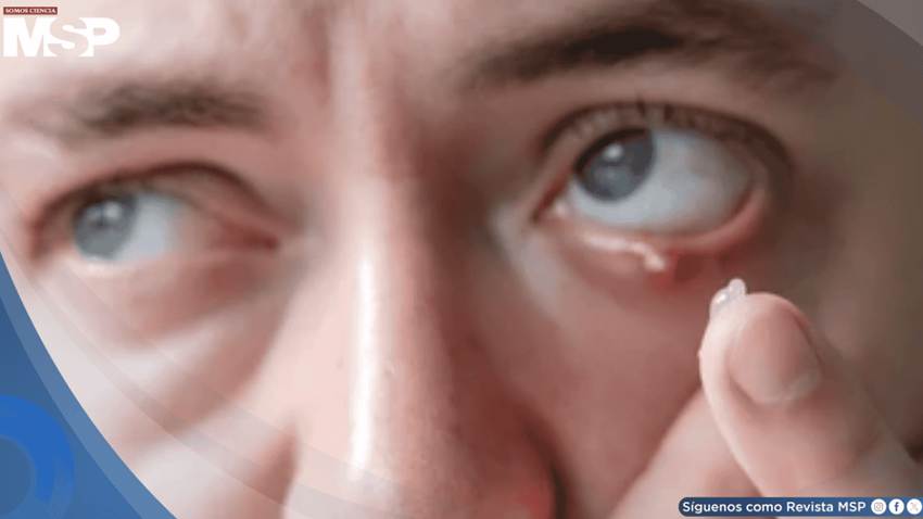 Orzuelos: por qué aparecen, cómo tratarlos y qué hacer para prevenirlos