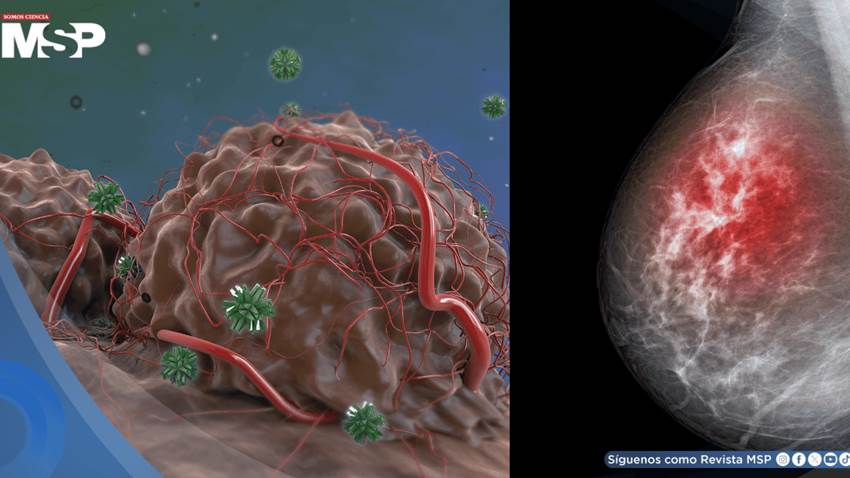 Descubren que el cáncer de mama resistiría las terapias hormonales gracias a la proteína FOXA1