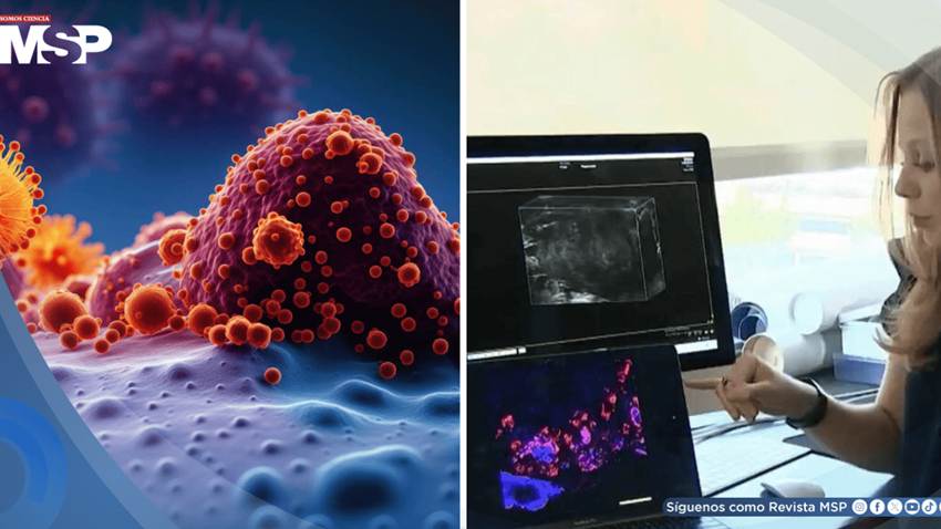 Desarrollan vacuna que lograría prevenir el melanoma, cáncer de páncreas y el de mama triple negativo