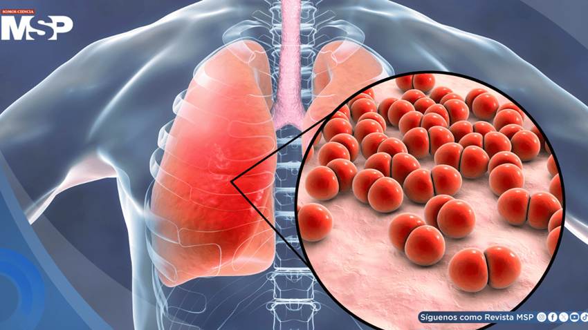 Moho en casa y humo de velas aromáticas provocarían inflamación crónica al contaminar el aire interior