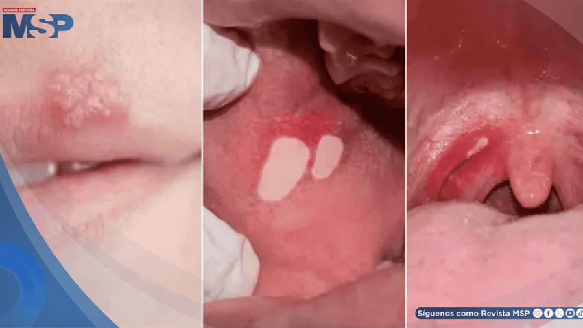 7 enfermedades que puedes contraer por practicar sexo oral y cómo prevenirlas