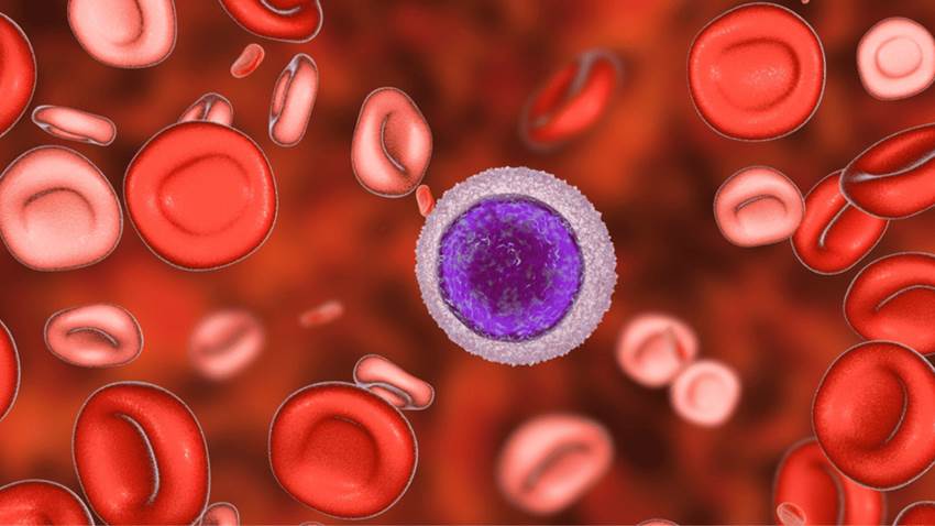 Seguimiento periódico de la leucemia linfocítica es más esencial que el propio tratamiento