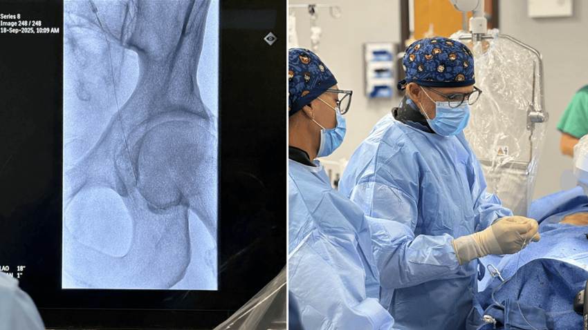 HT Command: Inician producción de cables guía avanzados para procedimientos cardiovasculares en la isla