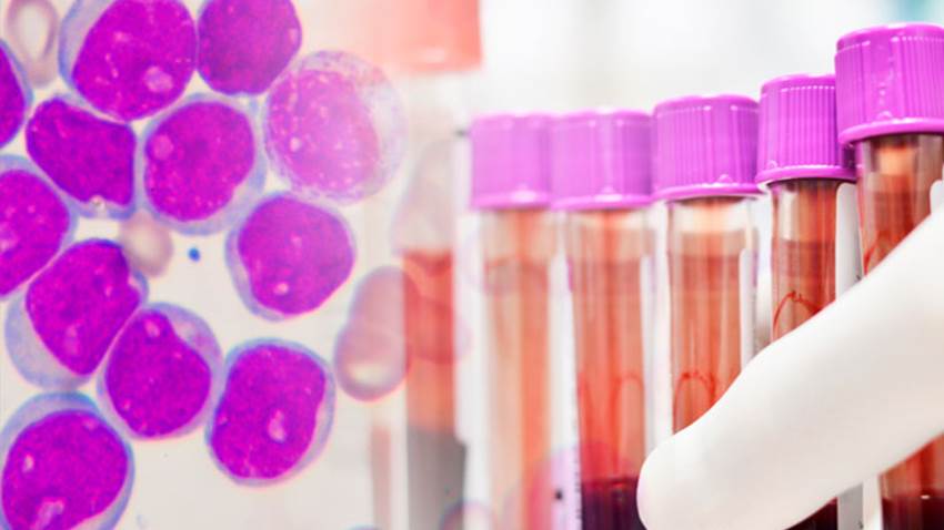 FDA aprueba Venclexta®  para leucemia mieloide aguda