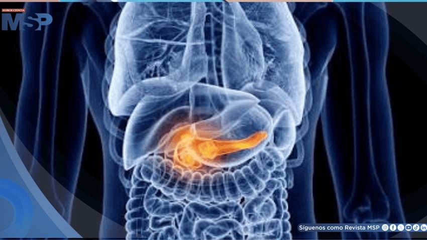 Pancreatitis aguda biliar : Dolor abdominal agudo y evolución clínica complicada en una paciente joven