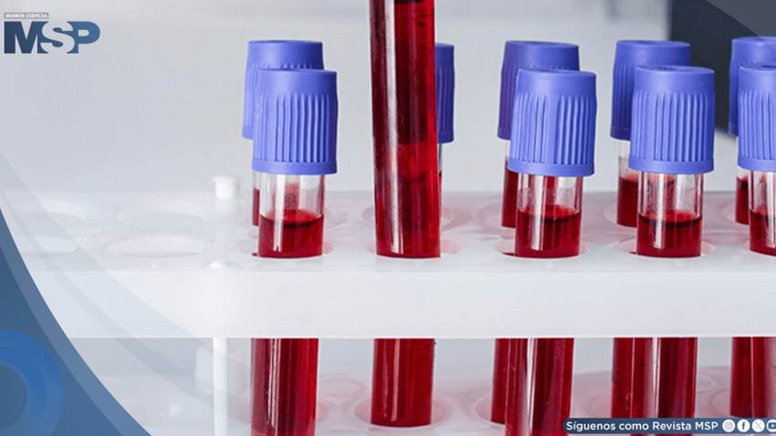 Estos son los errores más comunes que podrían alterar los resultados de análisis de sangre