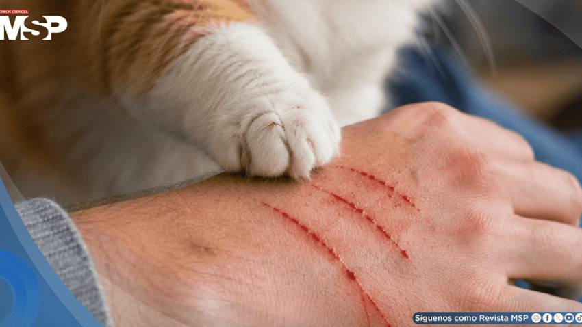 Infecciones por rasguños de gato y micobacterias pueden confundirse con cáncer y retrasar el diagnóstico