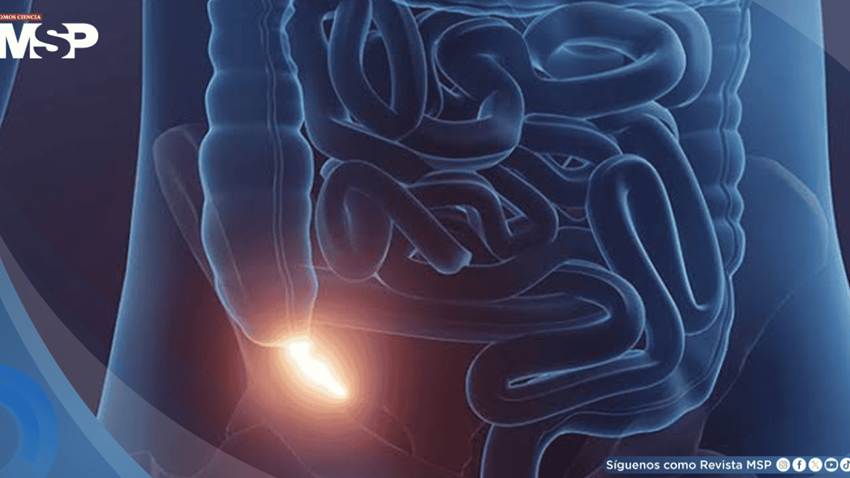 Apendicitis: Emergencia médica que requiere atención inmediata