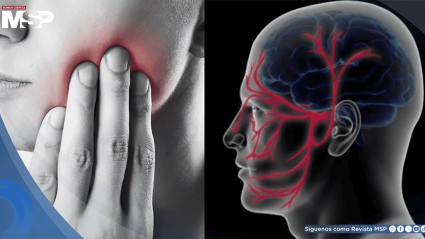 Dolor facial súbito o ´descarga eléctrica´ en el rostro: Así se reconoce la neuralgia del trigémino