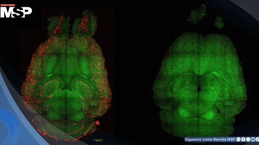 Logran revertir el alzhéimer en roedores mediante una terapia con nanopartículas bioactivas