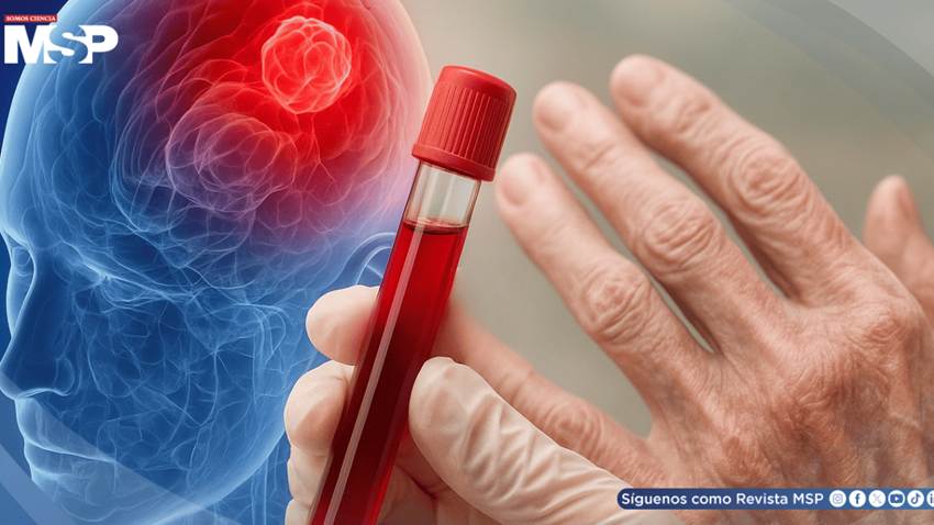 Nuevo análisis de sangre podría detectar el párkinson en fases tempranas, según investigadores