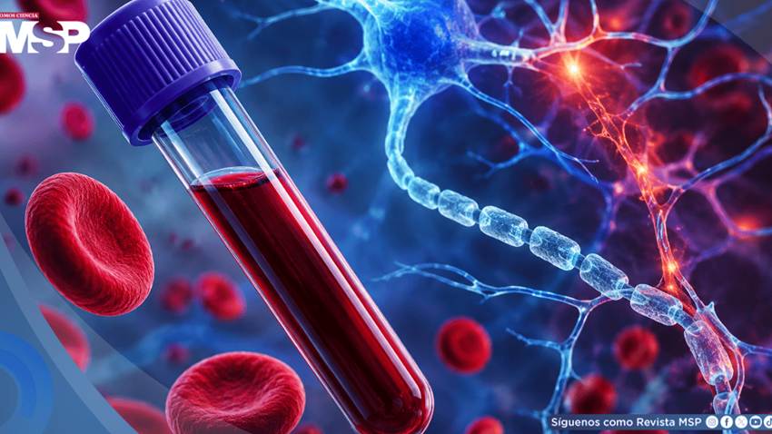 Proteínas en la sangre podrían anticipar la esclerosis múltiple más de una década antes del diagnóstico