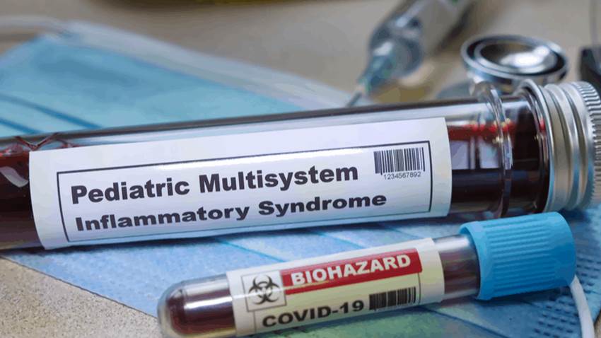 Síndrome inflamatorio grave en niños contagiados con COVID-19
