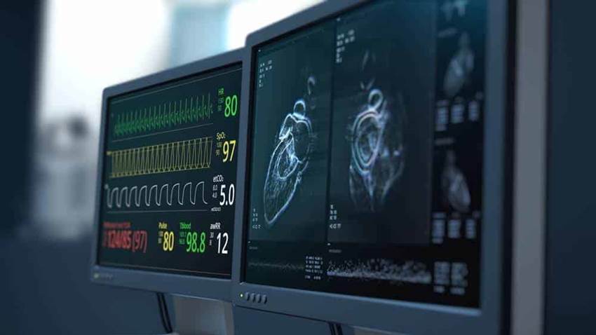 Estudio asocia alta frecuencia cardiaca en reposo con riesgo de demencia
