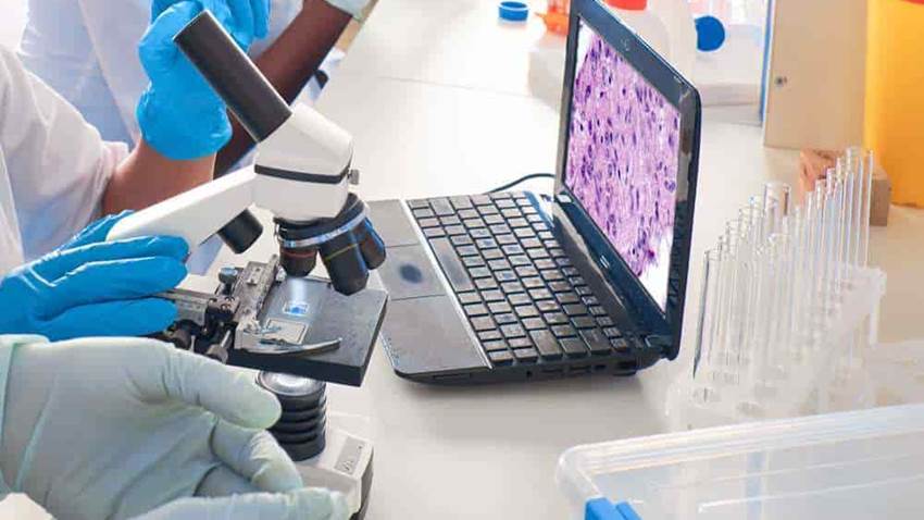 La biopsia líquida, capaz de detectar precozmente el cáncer de pulmón
