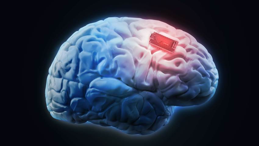 Ética de privacidad en implantes cerebrales: ¿Qué pasaría si la tecnología pudiera leer tu mente?